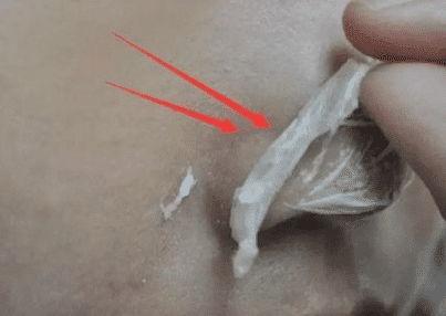 如何拉黑头条上的人